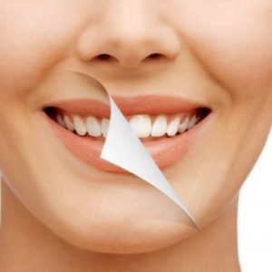 smile-makeover-geetanjali-dental-options
